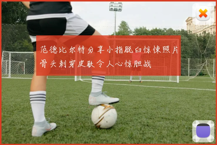范德比尔特分享小指脱臼惊悚照片骨头刺穿皮肤令人心惊胆战